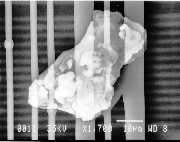 SEM image showing titanium-tungsten particle bridging several metal 3 lines. (Photo courtesy Sandia Labs).