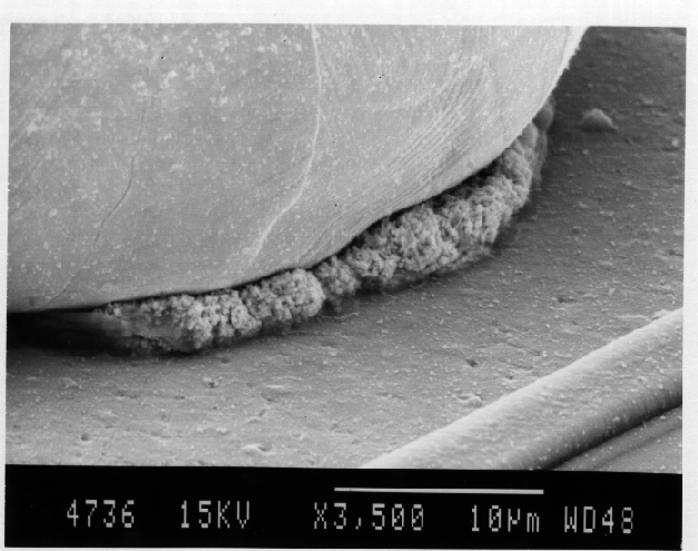 High magnification image of intermetallic growth. (Courtesy DM Data).