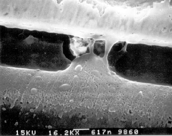 Higher magnification image of the metal to substrate short. (Courtesy Analytical Solutions).